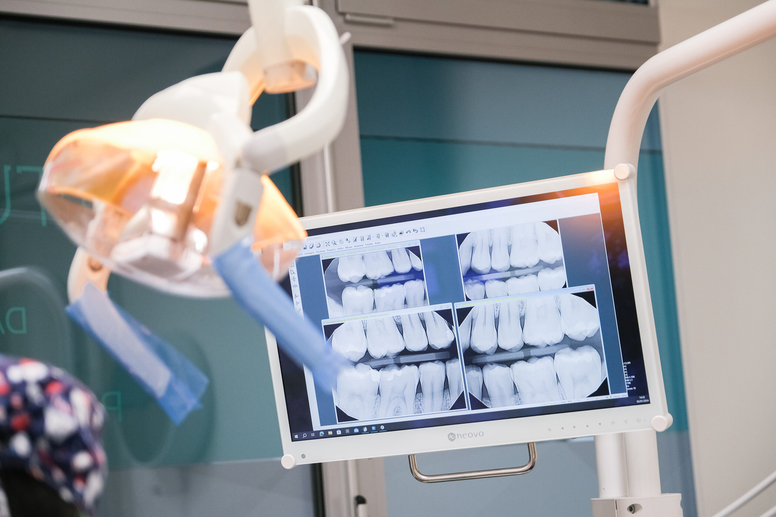 Radiografie per valutazione